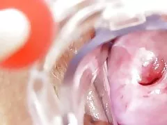 Қонақ La enfermera cochina БП каеда " солас